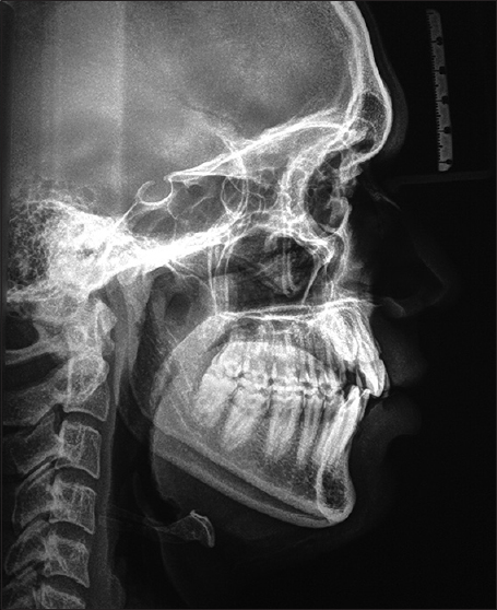 Dental X-RAY in Pune