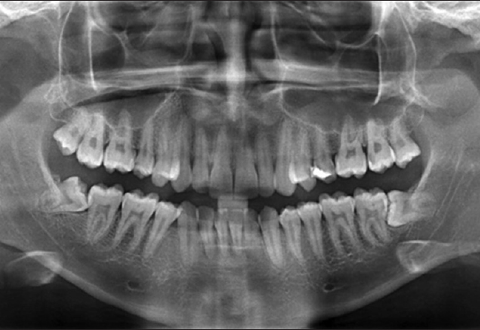 Best Dental X-ray-OPG center in pune